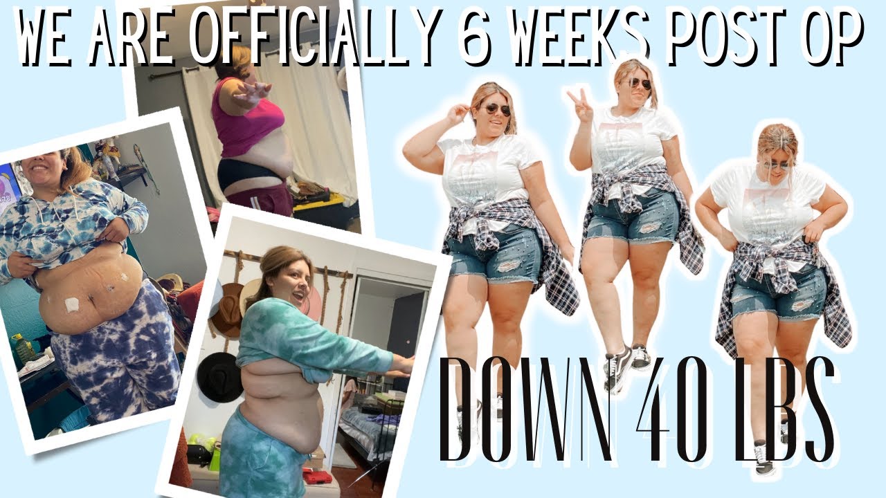 WE ARE OFFICIALLY 6 WEEKS POST OP | LETS TALK GOOD BAD AND UGLY 6WEEK VLOG | BARIATRIC SURGERY