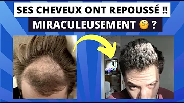 Est-ce que les cheveux repoussent après 60 ans