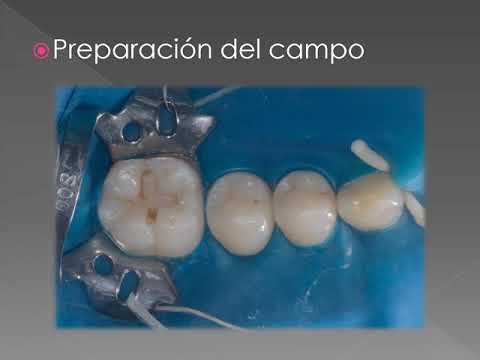 Video: Lesiones Generacionales-2