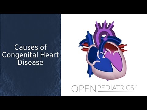 Poliklinika Harni - Dijagnostika srčanih mana kod alkoholnog fetalnog sindroma