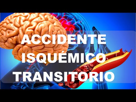 Video: Cómo diagnosticar un AIT (con imágenes)