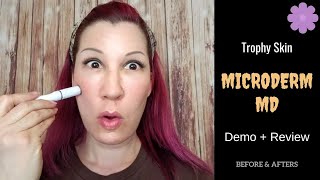 I'm a vain, mid-40's something woman who is always looking for the
latest and greatest products out there to help me in battle with my
aging skin. i saw ...