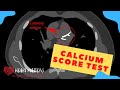 All About the Calcium Score | Heart Scan