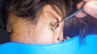 Removing Grandma's 70 Year Old Earwax | It's STUCK!