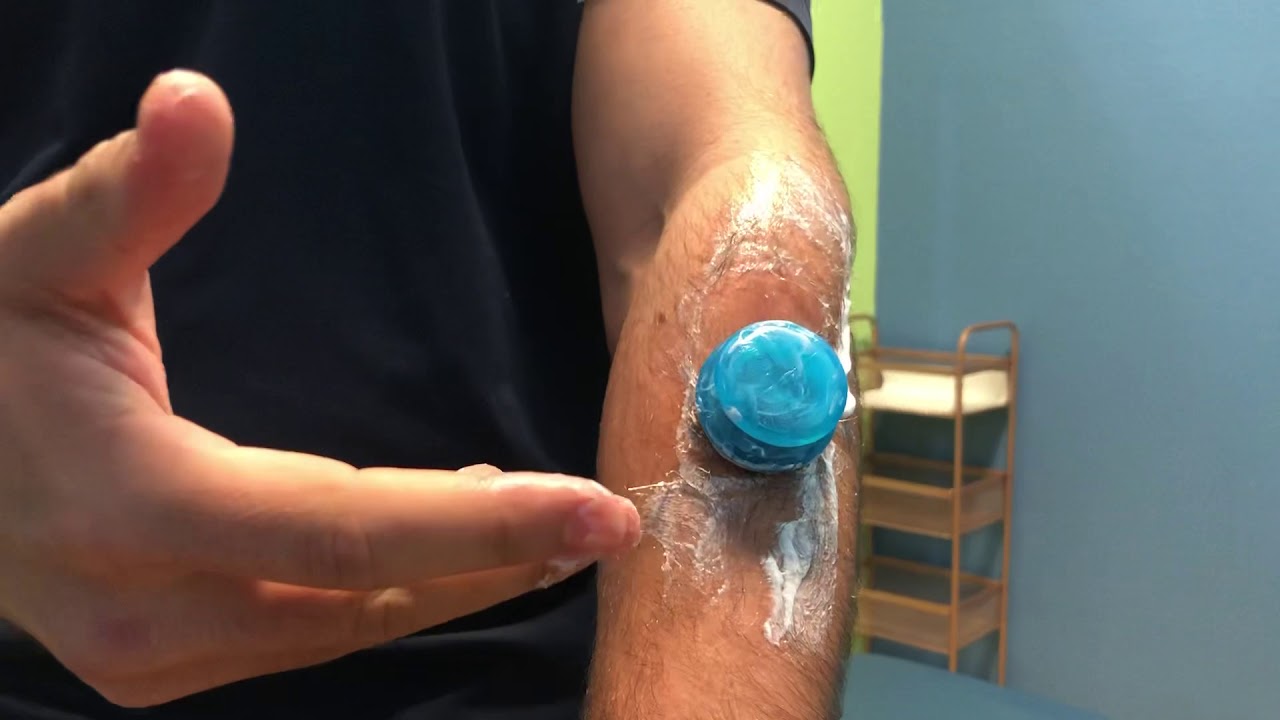 How to treat Medial / Lateral Epicondylitis YOURSELF! YouTube