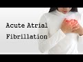 Acute Atrial Fibrillation