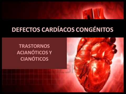 Vídeo: Diferença Entre Defeitos Cardíacos Congênitos Cianóticos E Acianóticos