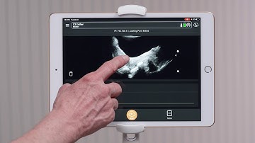 Clarius Feature: Reviewing and Deleting Images