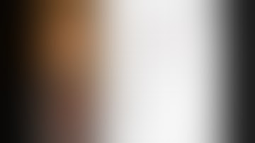 Post Myocardial Infarction Left Ventricular Pseudo-aneurysm