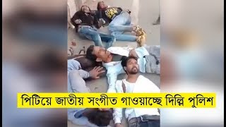 পিটিয়ে জাতীয় সংগীত গাওয়াচ্ছে পুলিশ|These injured people are laying down singing National Anthem