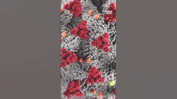 The nocebo effect: When negative thoughts turn into reality