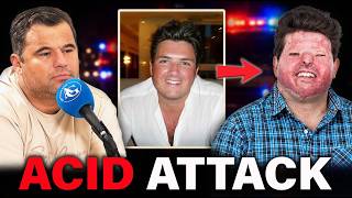 "They Threw Acid in My Face… But I Was the Wrong Man"