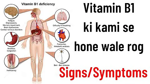 Vitamin B1/ Thiamine ki kami se hone wali bimari (rog), Vitamin b1 deficiency symptoms in hindi