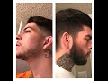 SUCCESSFUL BEARD ROGAINE (MINOXIDIL) 4 MONTH EXPERIMENT