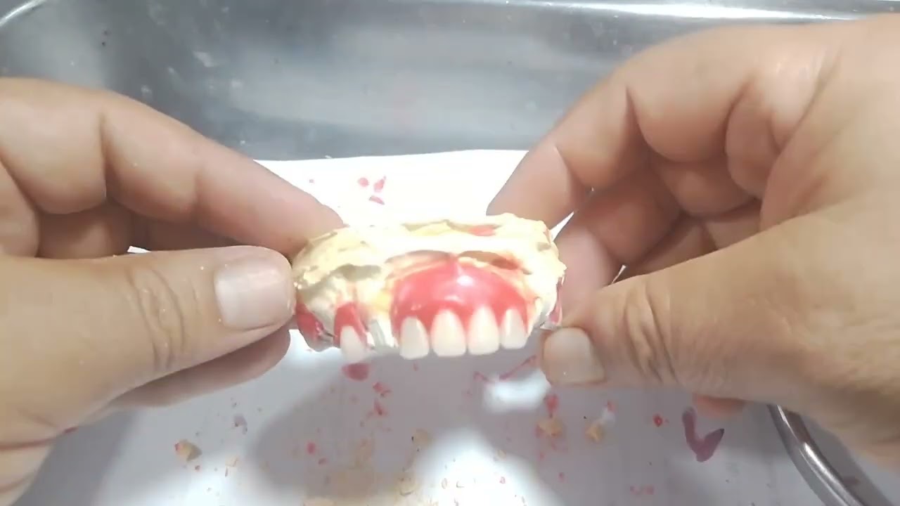 !!! COMO SE HACEN LAS PROTESIS DENTALES PASO A PASO VIDEO 11 COMPLEMENTO.