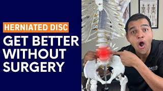 Hernie de disc: Tot ce trebuie să știi