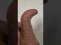 Can Your Thumb Do This?