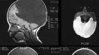 Scientists think they located consciousness in the brain 