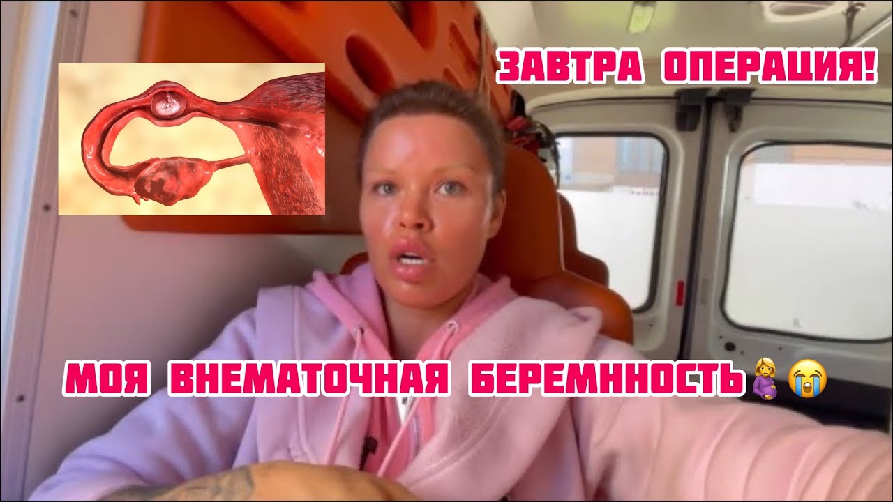 МОЯ ВНЕМАТОЧНАЯ БЕРЕМЕННОСТЬ 🤰😭ЗАВТРА ТЯЖЕЛАЯ ОПЕРАЦИЯ! #эко # ...