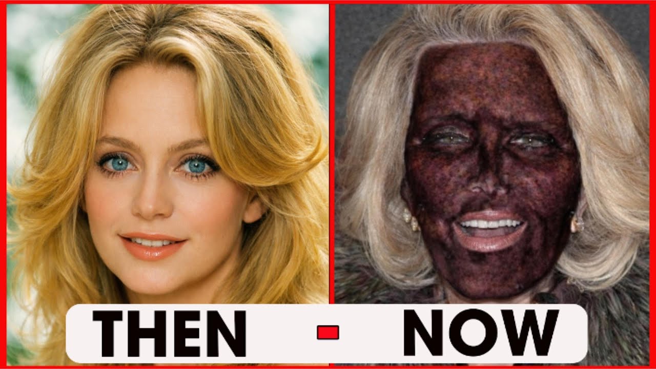 18 Celebrities Who Completely Ruined Their Faces With Plastic Surgery | Then And Now 2026