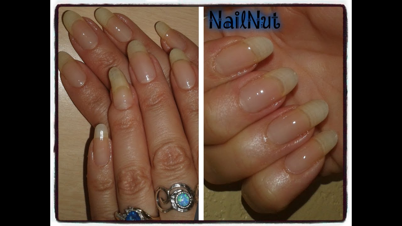 10. Nail strengthening treatment - wide 6