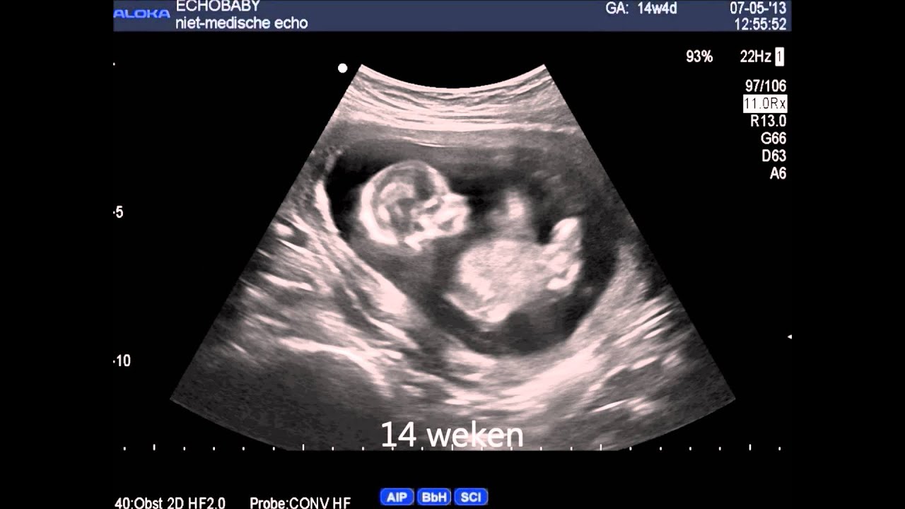 26 Weken Zwanger. Je Baby Is In Volle Groei.