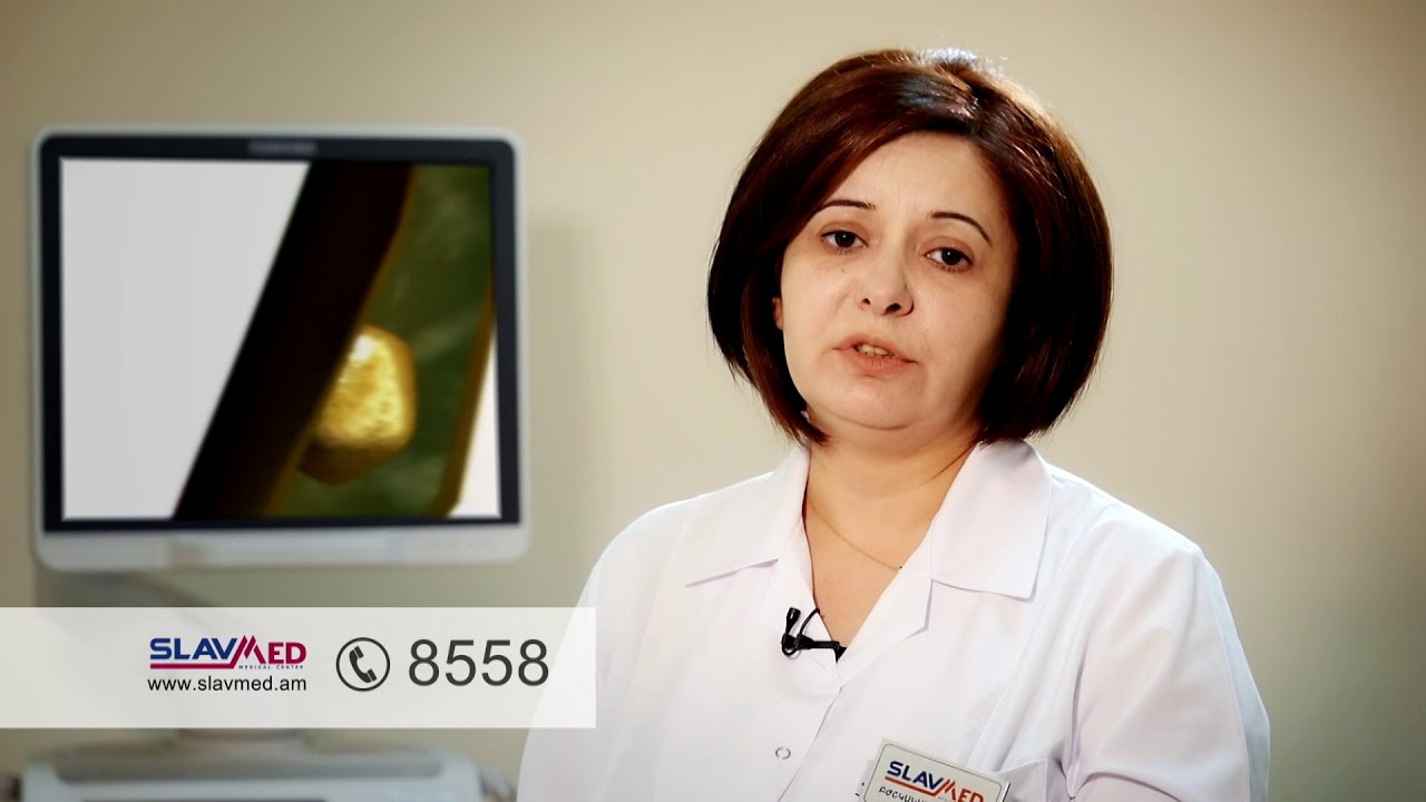 3D և 4D ուլտրաձայնային հետազոտություն «Սլավմեդ» բժշկական կենտրոնում