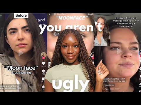 What Really Happened To Alissiababee?