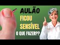 Retirou Onicofose e Ficou Sensível O que Fazer