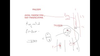 AXIAL & RAY PARENCHYMA IN XYLEM AND TYLOSIS / BY PROF. DR . M . AFZAL