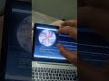 kaleidoscope mediapipe