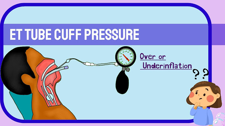 Endotracheal tube ขนาด 5.5 ไม ม cuff