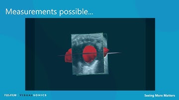 4D Mode  - Available only on the Vevo 3100