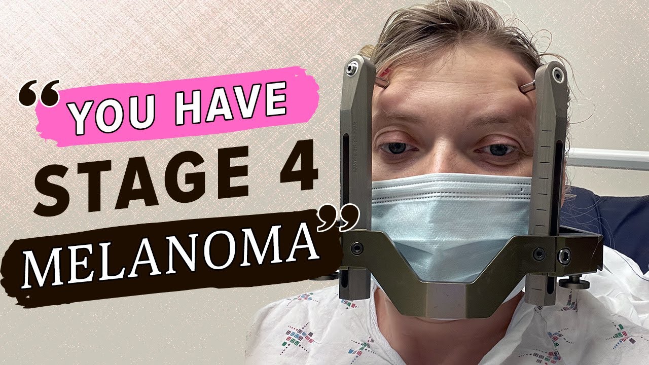 Witness My Cancer stage 4 Journey My Melanoma Story 2023 with photos