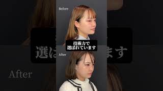 顎下脂肪吸引もDr.もりもり#小顔整形
