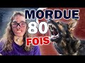 Survivante dattaque de chiens fou