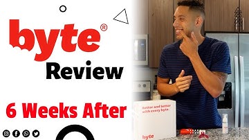 Byte Aligners Review 6 weeks Before and After - Byte Discount Code SAINT