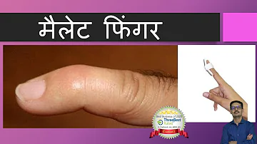 Mallet Finger Hindi