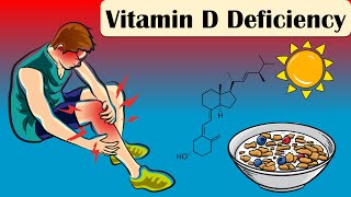 Vitamin D Deficiency - Causes, Signs, And Symptoms - Everything You Need To Know