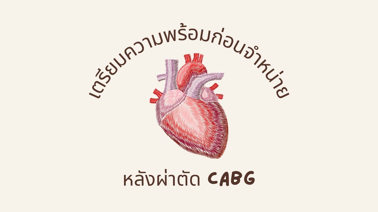 การเตรียมความพร้อมก่อนจำหน่ายหลังผ่าตัดทำทางเบี่ยงหลอดเลือดหัวใจ(CABG) | D-METHOD