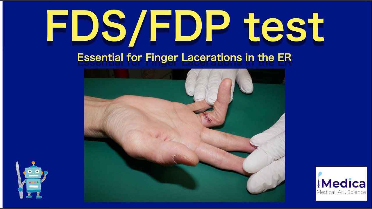 FDS and FDP Tests Explained | ER Finger Laceration Exam Guide - YouTube