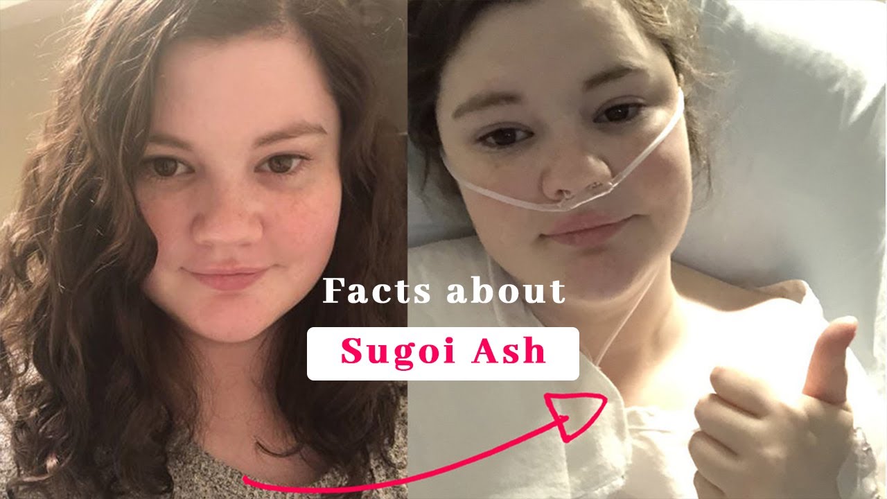 Quick Fact About Sugoi Ash | Age, Ash On Lol Face Reveal, Earnings, Twitch, Birthday