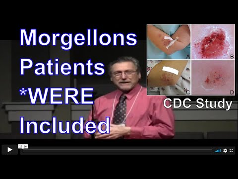 Morgellons Discussion and Microscopy Videos