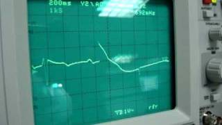 12 LEAD ECG PART 2 ENGLISH VERSION.MPG