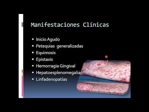 Clase 49 - Purpura Trombocitopenica Idiopatica Aguda