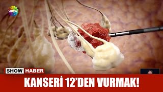Kanseri 12'den vurmak!
