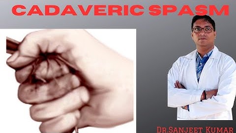 Tutorial  86 -- CADAVERIC SPASM