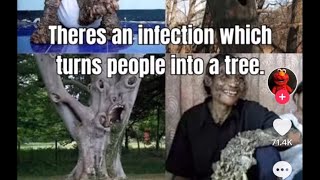 This Syndrome Will Turn You Into A Tree 