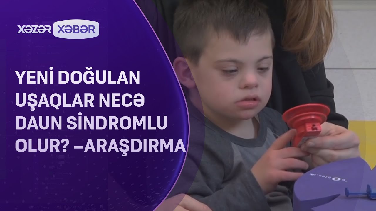 Yeni doğulan uşaqlar necə daun sindromlu olur? - ARAŞDIRMA