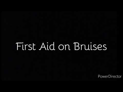 First Aid on Bruises